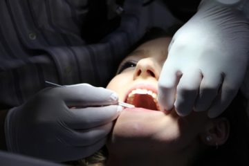 extraire dents sagesse