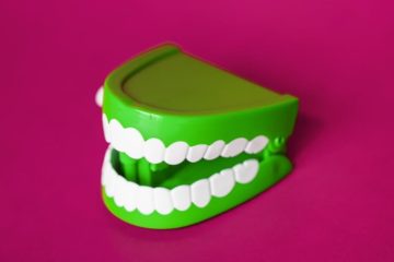 malocclusion dentaire